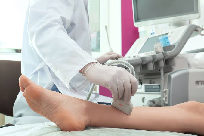 Alt Ekstremite Arteriyel Sistem Renkli Doppler Ultrason