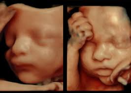 4 boyutlu (4D) renkli ultrason ile bebek görüntüsü